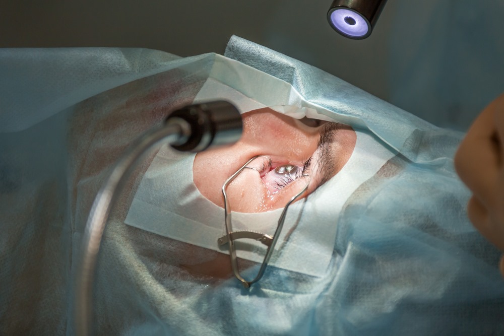 Comparing LASIK Turkey Clinics: How to Pick the Best