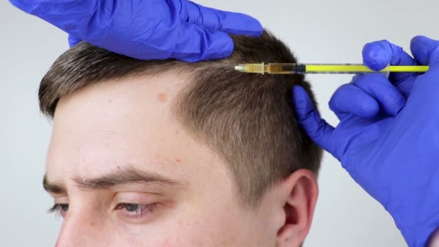 Hair Transplant Turkey: Experience World-Class Medical Tourism